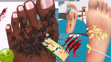 Foot Clinic Asmr Feet Care Game / Walkthrough / Gameplay / Part1